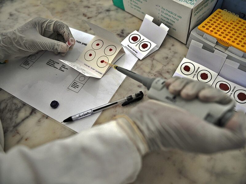 На Сумщині від тропічної малярії помер чоловік