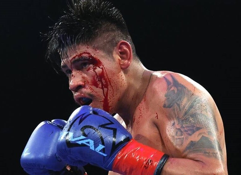 Наваррет пролив світло на суперечливий момент зупинки його бою з Суаресом