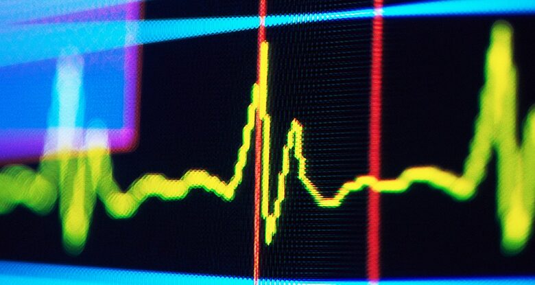 Ритм у пульсі людини може сигналізувати про майбутнє когнітивне погіршення