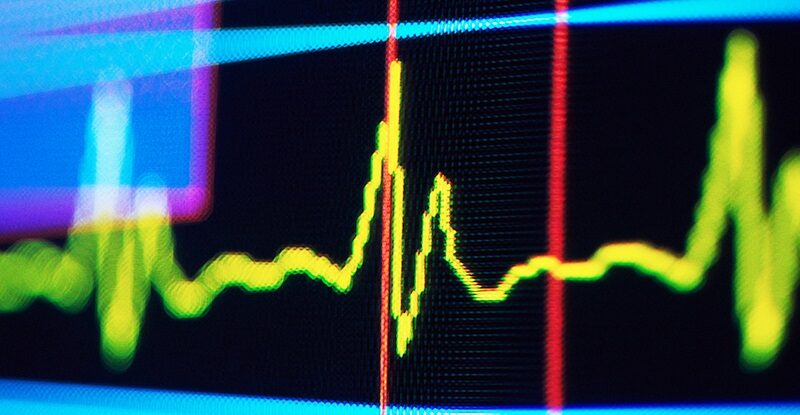 Ритм у пульсі людини може сигналізувати про майбутнє когнітивне погіршення