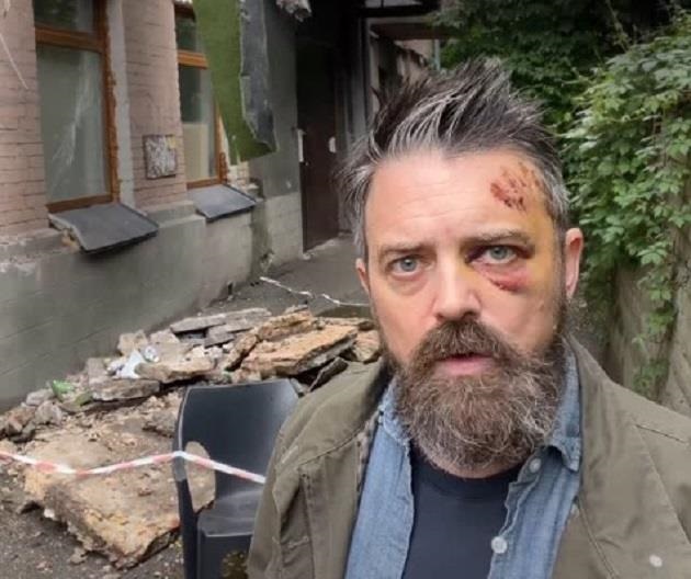 У Києві на американця впав балкон – КМВА