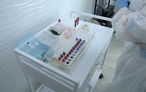 У Києві зафіксовано 83 випадки захворювання на гепатит А