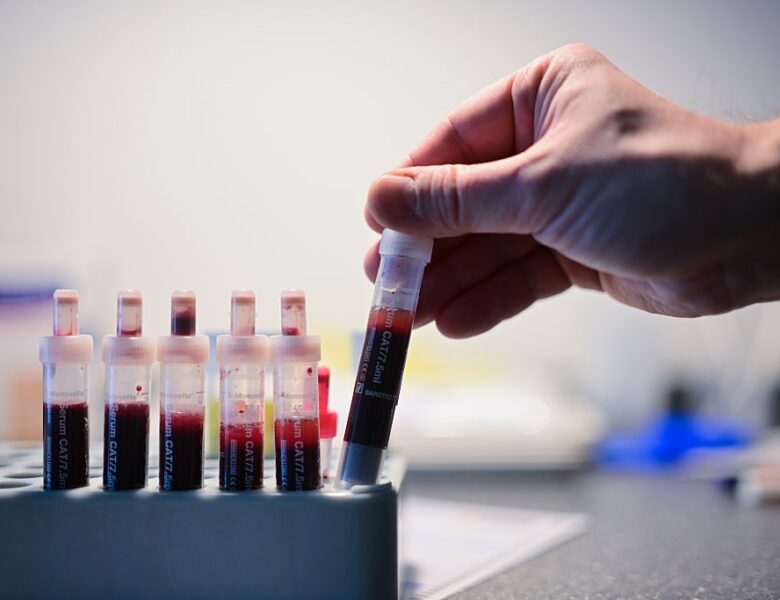 Відомо, скільки випадків ВІЛ-інфекції зафіксували в Україні з початку року