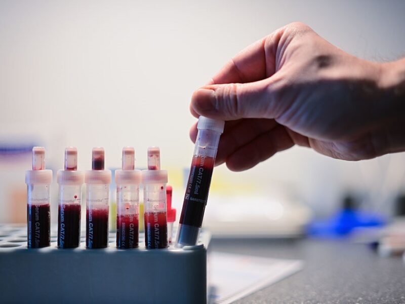 Відомо, скільки випадків ВІЛ-інфекції зафіксували в Україні з початку року