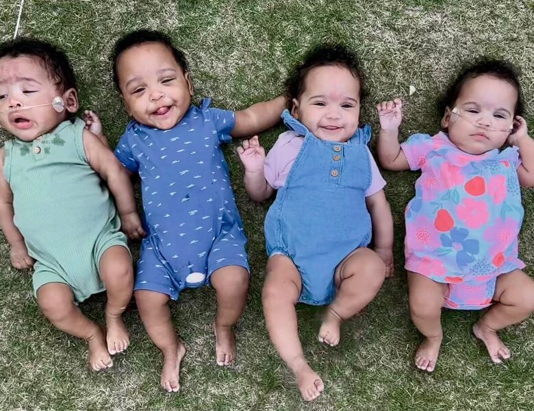 В США народилась найпередчасніша четвірня в історії