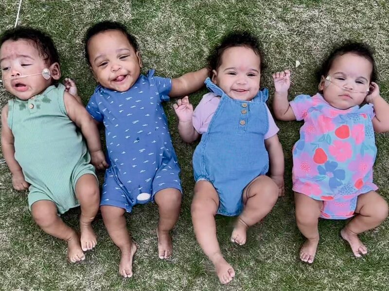 В США народилась найпередчасніша четвірня в історії