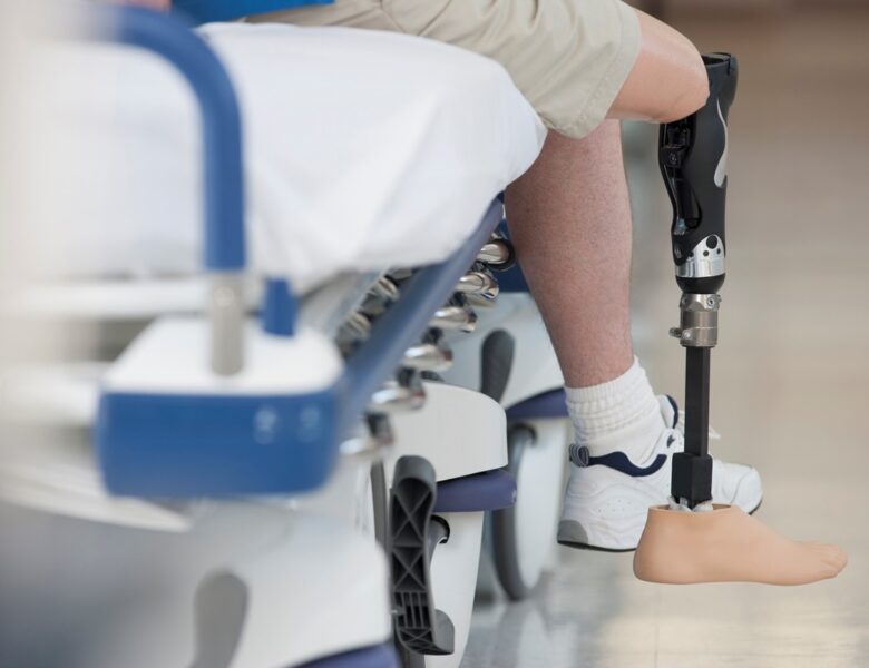 Саудівська Аравія запустила п’ятий етап протезування українців