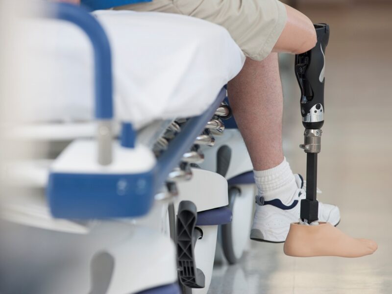 Саудівська Аравія запустила п’ятий етап протезування українців