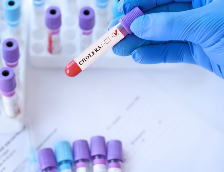 У Польщі перший випадок холери за шість років