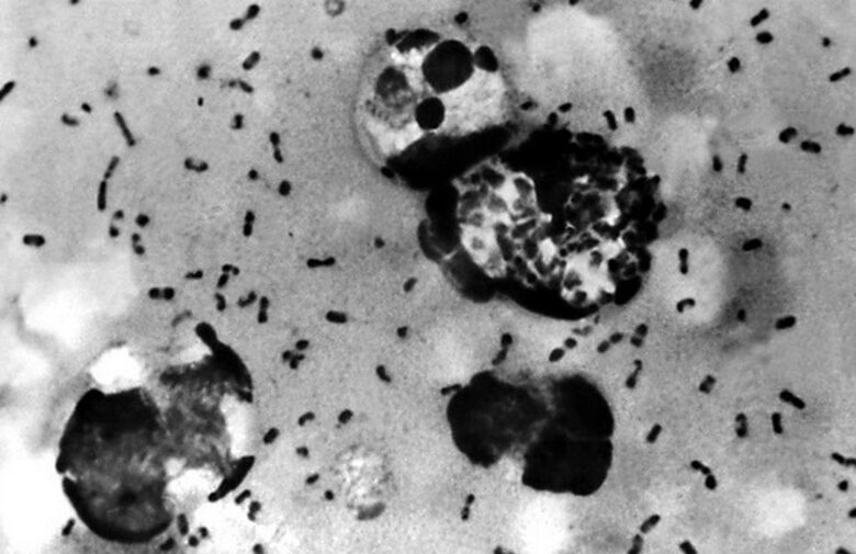 У штаті Аризона зареєстровано першу з 2007 року смерть від чуми