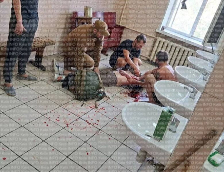 У Києві мобілізований порізав собі руки та шию на збірному пункті