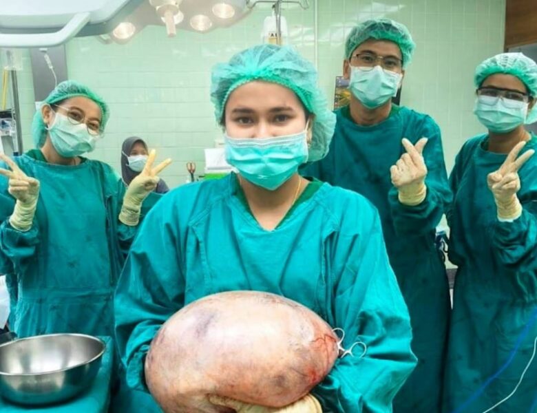 В Таїланді лікарі видалили 8-кілограмову кісту