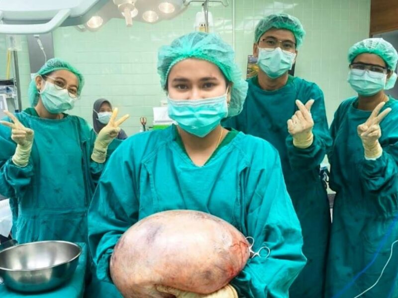 В Таїланді лікарі видалили 8-кілограмову кісту