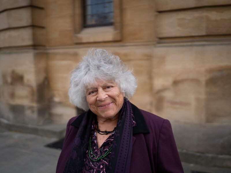 Зірка Гаррі Поттера зізналася у труднощах старості