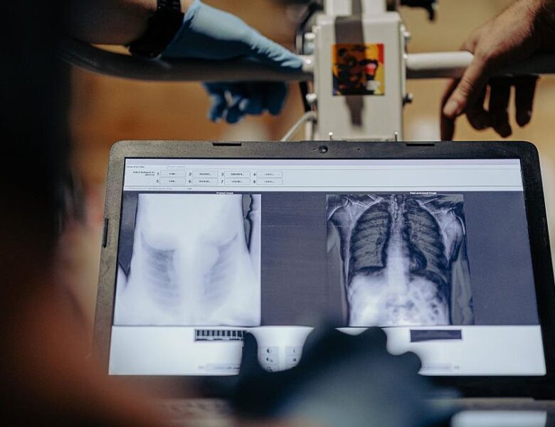 У ЗСУ цифровізують медицину – Сирський