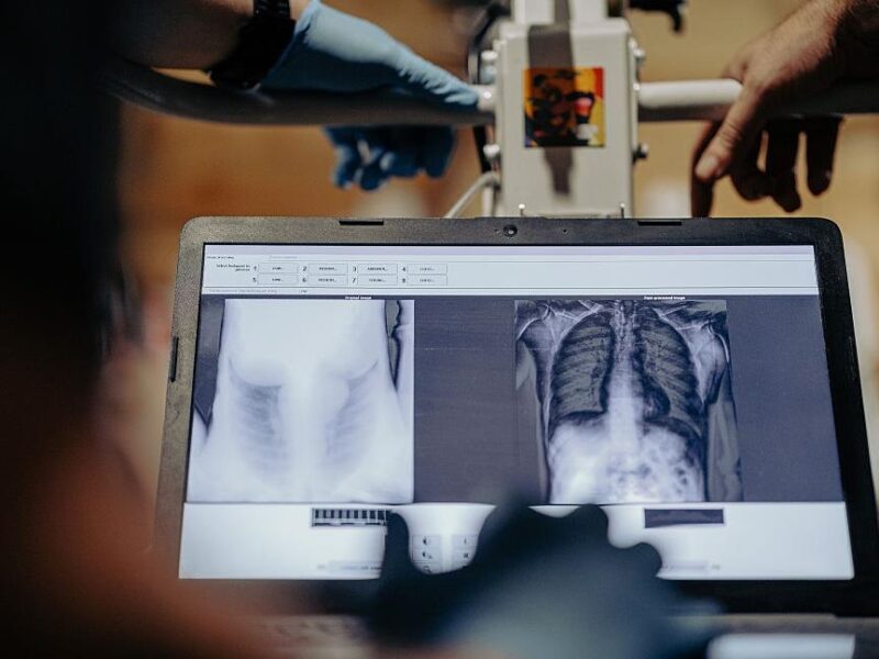 У ЗСУ цифровізують медицину – Сирський