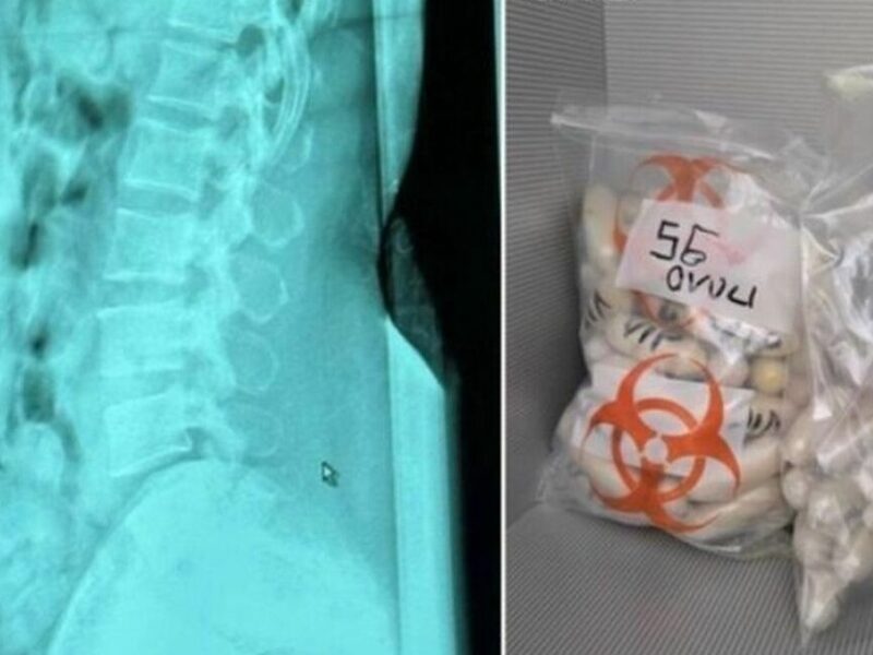 В Італії затримано жінку з 1,4 кг героїну в шлунку