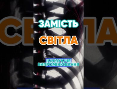Чому рентген показує кістки? 🦴 #наука #цікаво #рентген #медицина