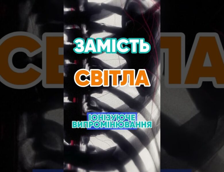 Чому рентген показує кістки? 🦴 #наука #цікаво #рентген #медицина