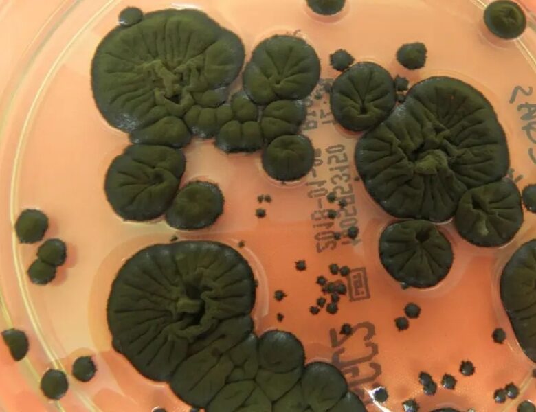 NASA розглядає чорнобильські гриби як новий захист від радіації в космосі