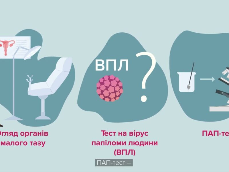 Турбота про жіноче здоров’я починається з профілактики