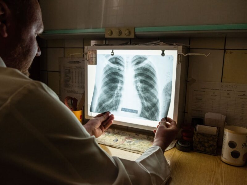 В Україні з’являються випадки позалегеневого туберкульозу – ЦГЗ