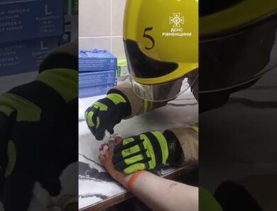 Хірургічна точність: на Рівненщині рятувальники вивільнити палець підлітка із металевої «пастки»
