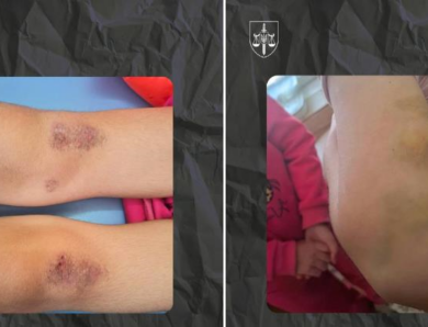 На Полтавщині опікунка катувала молодших сестер