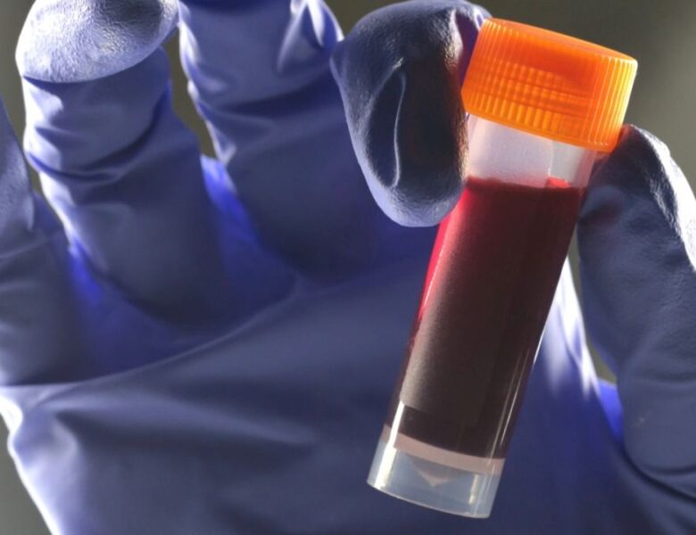 Вчені виявили зв&rsquo;язок між групою крові та ризиком діабету 2 типу