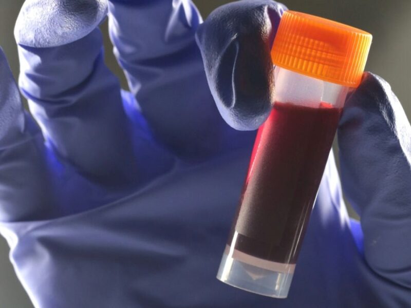 Вчені виявили зв&rsquo;язок між групою крові та ризиком діабету 2 типу