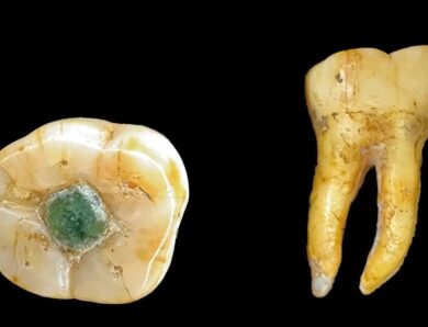 Давні мая використовували дорогоцінні камені як пломби