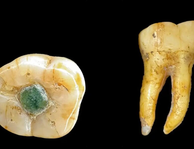 Давні мая використовували дорогоцінні камені як пломби