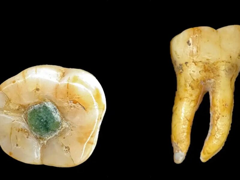 Давні мая використовували дорогоцінні камені як пломби