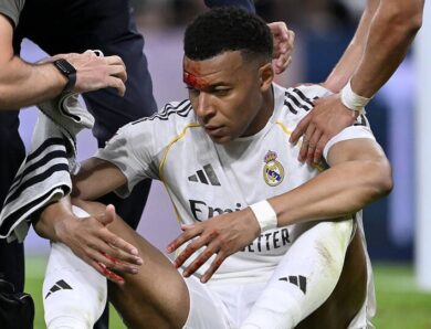 Розтин не перешкода: Мбаппе очікують у матчі Ліги чемпіонів