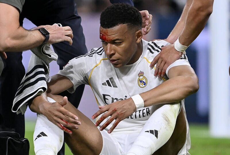 Розтин не перешкода: Мбаппе очікують у матчі Ліги чемпіонів