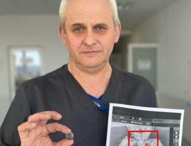 У Львові врятували дитину, яка місяцями жила з батарейкою у стравоході