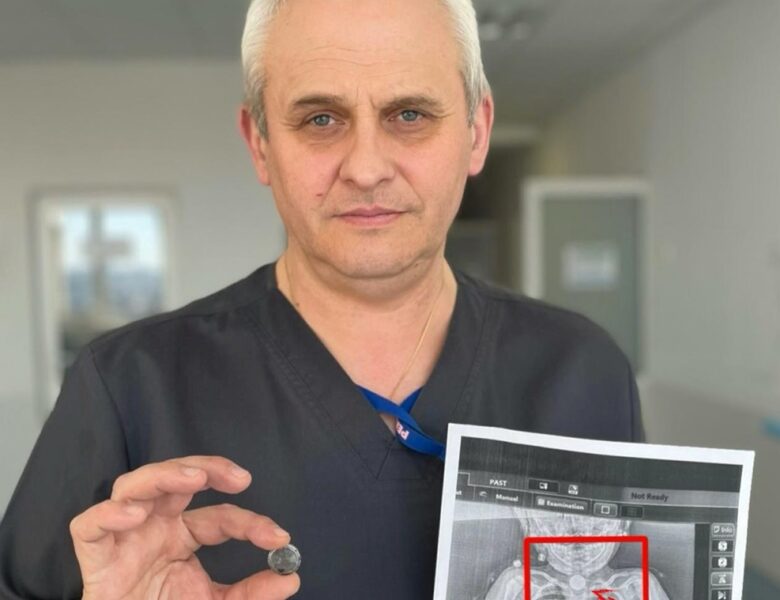 У Львові врятували дитину, яка місяцями жила з батарейкою у стравоході