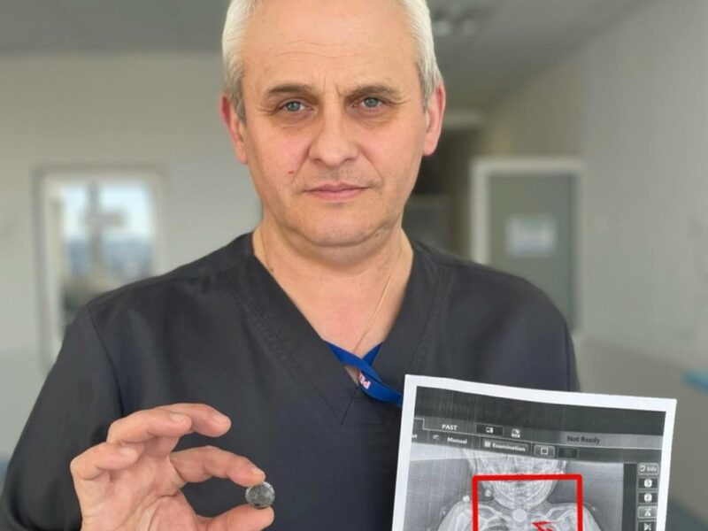 У Львові врятували дитину, яка місяцями жила з батарейкою у стравоході