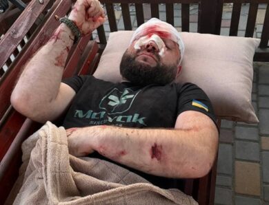 На Одещині жорстоко побили військового за зауваження про російську музику